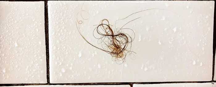 Волосы выпадают при мытье