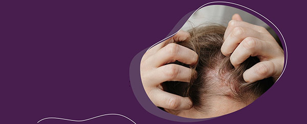 Воспаление кожи головы вызывает выпадение волос: причины и решения